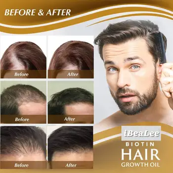IBeaLee Proizvoda Za Rast Kose Biotin Brzorastuće Kosa Eterično Ulje Za Njegu Kose i Sprječava Gubitak Kose Tretman Vlasišta Za Muškarce Wom E6P3