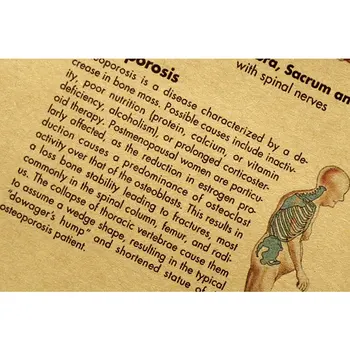 Ilustracija iz ljudskog tijela-detaljno objašnjenje strukture kralježnice kraft-papir retro poster je super soba muzej dekor naljepnice za zid